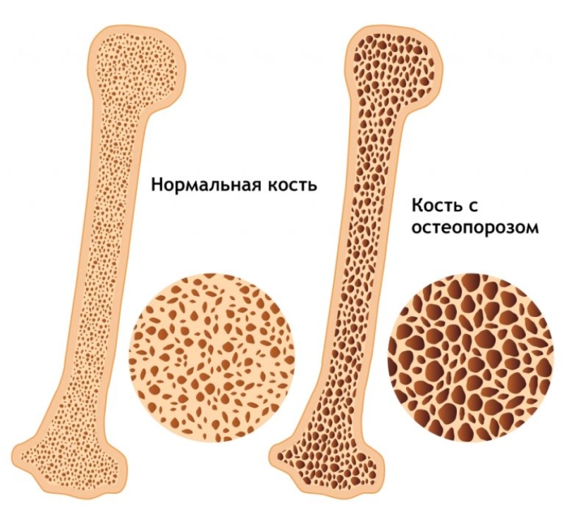 68f4101b8459ef20d840b9cc71280bcc.jpg 68f4101b8459ef20d840b9cc71280bcc.jpg